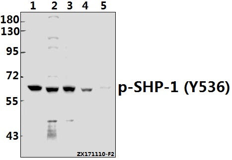 Western blot (WB) analysis of SHP-1 (phospho-Y536) polyclonal antibody at 1:500 dilution
Lane1:MCF-7 whole cell lysate(40ug)
Lane2:H1792 whole cell lysate(40ug)
Lane3:A549 whole cell lysate(40ug)
Lane4:3T3-L1 whole cell lysate(40ug)
Lane5:H9C2 whole cell lysate(40ug)