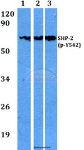 Western blot (WB) analysis of p-SHP-2 (Y542) polyclonal antibody at 1:500 dilution
Lane1:A549 whole cell lysate
Lane2:Raw264.7 whole cell lysate
Lane3:H9C2 whole cell lysate