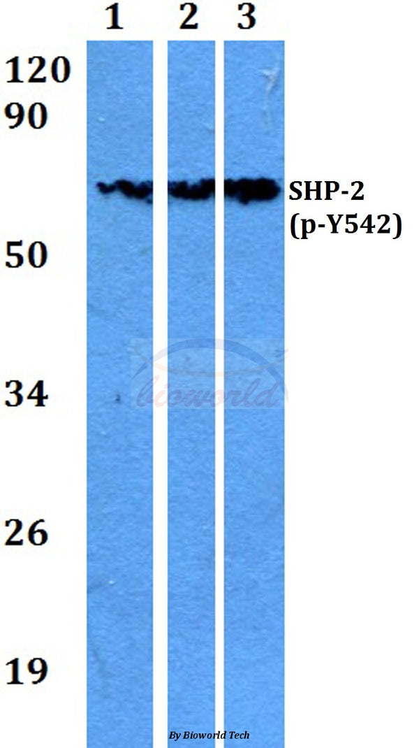 Western blot (WB) analysis of p-SHP-2 (Y542) polyclonal antibody at 1:500 dilution
Lane1:A549 whole cell lysate
Lane2:Raw264.7 whole cell lysate
Lane3:H9C2 whole cell lysate