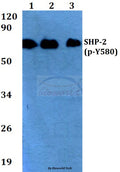 Western blot (WB) analysis of p-SHP-2 (Y580) polyclonal antibody at 1:500 dilution
Lane1:HEK293T whole cell lysate
Lane2:Raw264.7 whole cell lysate
Lane3:H9C2 whole cell lysate