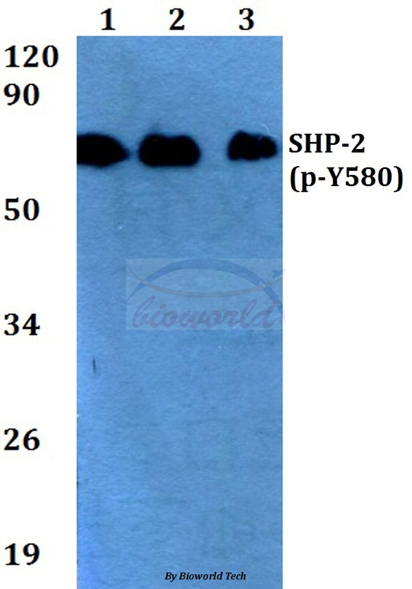 Western blot (WB) analysis of p-SHP-2 (Y580) polyclonal antibody at 1:500 dilution
Lane1:HEK293T whole cell lysate
Lane2:Raw264.7 whole cell lysate
Lane3:H9C2 whole cell lysate