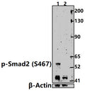 Western blot (WB) analysis of Smad2 (phospho-Ser467) polyclonal antibody at 1:500 dilution
Lane1:HepG2 treated with TGF-β(100 ng/ml,30 minutes) whole cell lysate(30ug)                                                                                           Lane2:HepG2 whole cell lysate(30ug)