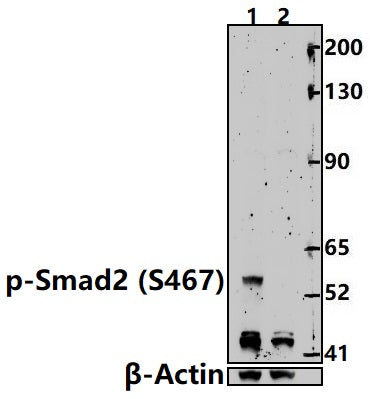 Western blot (WB) analysis of Smad2 (phospho-Ser467) polyclonal antibody at 1:500 dilution
Lane1:HepG2 treated with TGF-β(100 ng/ml,30 minutes) whole cell lysate(30ug)                                                                                           Lane2:HepG2 whole cell lysate(30ug)