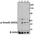 Western blot (WB) analysis of Smad3 (phospho-Ser425) polyclonal antibody at 1:500 dilution
Lane1:A549 treated with λ-phosphatase whole cell lysate(30ug)
Lane2:A549 whole cell lysate(30ug)
Lane3:A549 treated with TGF-β(10 ng/ml,30 minutes) whole cell lysate(30ug)                                                                                           Lane4:A549 whole cell lysate(30ug)