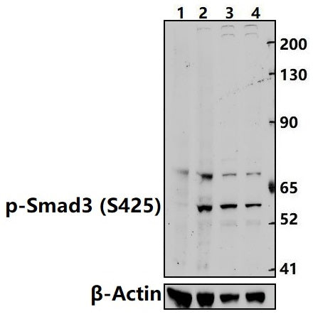 Western blot (WB) analysis of Smad3 (phospho-Ser425) polyclonal antibody at 1:500 dilution
Lane1:A549 treated with λ-phosphatase whole cell lysate(30ug)
Lane2:A549 whole cell lysate(30ug)
Lane3:A549 treated with TGF-β(10 ng/ml,30 minutes) whole cell lysate(30ug)                                                                                           Lane4:A549 whole cell lysate(30ug)