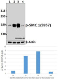 Western blot (WB) analysis of p-SMC 1 (S957) pAb at 1:500 dilution
Lane1:SGC7901 whole cell lysate(40ug)
Lane2:SGC7901 treated with UV for 5 minutes then repair for 1 hours whole cell lysate(40ug)
Lane3:SGC7901 treated with UV for 5 minutes then repair for 3 hours whole cell lysate(40ug)
Lane4:SGC7901 treated with UV for 5 minutes then repair for 16 hours whole cell lysate(40ug)