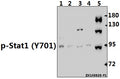 Western blot (WB) analysis of p-Stat1 (Y701) pAb at 1:500 dilution
Lane1:U-87MG whole cell lysate(40ug)
Lane2:Hela whole cell lysate(40ug)
Lane3:PC12 whole cell lysate(40ug)
Lane4:The Embyro tissue lysate of Mouse(40ug)
Lane5:Panc1 whole cell lysate(40ug)
