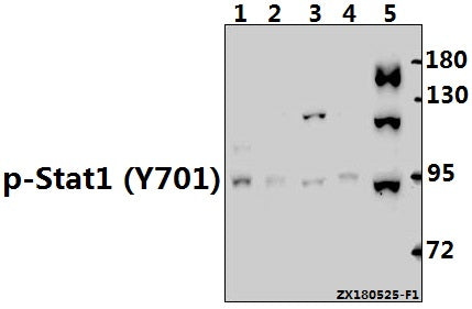 Western blot (WB) analysis of p-Stat1 (Y701) pAb at 1:500 dilution
Lane1:U-87MG whole cell lysate(40ug)
Lane2:Hela whole cell lysate(40ug)
Lane3:PC12 whole cell lysate(40ug)
Lane4:The Embyro tissue lysate of Mouse(40ug)
Lane5:Panc1 whole cell lysate(40ug)