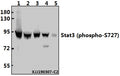 Western blot (WB) analysis of Stat3 (phospho-S727) polyclonal antibody at 1:500 dilution
Lane1:HepG2 whole cell lysate(40µg)
Lane2:A549 whole cell lysate(40µg)
Lane3:L02 whole cell lysate(40µg)
Lane4:PC12 whole cell lysate(40µg)
Lane5:3T3-L1 whole cell lysate(40µg)
