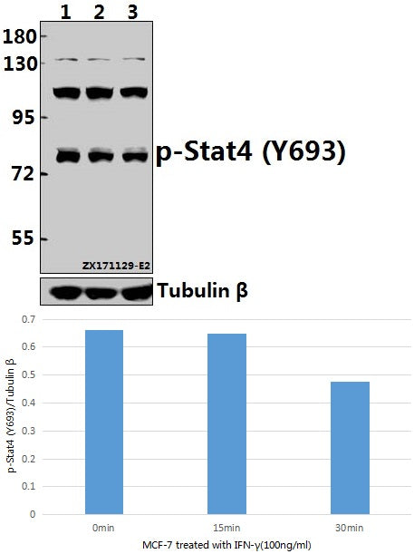 Western blot (WB) analysis of p-Stat4 (Y693) pAb at 1:500 dilution
Lane1:MCF-7 whole cell lysate(40ug)
Lane2:MCF-7 treated with IFN-γ(100ng/ml,15 minutes) whole cell lysate(40ug)
Lane3:MCF-7 treated with IFN-γ(100ng/ml,30 minutes) whole cell lysate(40ug)