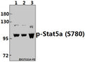Western blot (WB) analysis of p-Stat5a (S780) pAb at 1:500 dilution
Lane1:HepG2 whole cell lysate(40ug)
Lane2:MCF-7 whole cell lysate(40ug)
Lane3:L02 whole cell lysate(40ug)