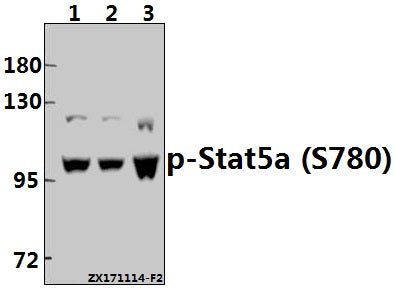 Western blot (WB) analysis of p-Stat5a (S780) pAb at 1:500 dilution
Lane1:HepG2 whole cell lysate(40ug)
Lane2:MCF-7 whole cell lysate(40ug)
Lane3:L02 whole cell lysate(40ug)