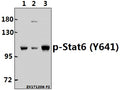 Western blot (WB) analysis of p-Stat6 (Y641) pAb at 1:500 dilution
Lane1:Hela whole cell lysate(40ug)
Lane2:A2780 whole cell lysate(40ug)
Lane3:SK-OVCAR3 whole cell lysate(40ug)