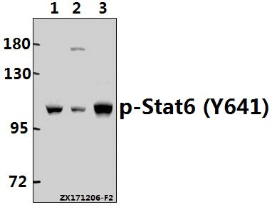 Western blot (WB) analysis of p-Stat6 (Y641) pAb at 1:500 dilution
Lane1:Hela whole cell lysate(40ug)
Lane2:A2780 whole cell lysate(40ug)
Lane3:SK-OVCAR3 whole cell lysate(40ug)