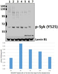 Western blot (WB) analysis of p-Syk (Y525) pAb at 1:500 dilution
Lane1:HEK293T whole cell lysate(40ug)
Lane2:HEK293T treated with UV for 5 minutes then repair for 4 hours whole cell lysate(40ug)
Lane3:HEK293T treated with UV for 5 minutes then repair for 6 hours whole cell lysate(40ug)
Lane4:HEK293T treated with UV for 5 minutes then repair for 16 hours whole cell lysate(40ug)
Lane5:HEK293T treated with UV for 5 minutes then repair for 24 hours whole cell lysate(40ug)
Lane6:The Lung tissue lysat