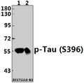 Western blot (WB) analysis of Tau (phospho-S396) polyclonal antibody at 1:500 dilution
Lane1:The Brain tissue lysate of Mouse(40ug)
Lane2:The Brain tissue lysate of Rat(40ug)