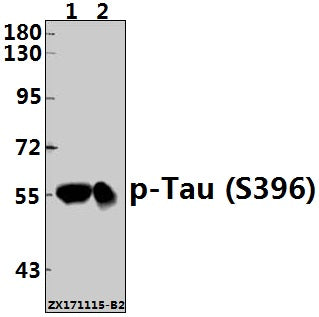 Western blot (WB) analysis of Tau (phospho-S396) polyclonal antibody at 1:500 dilution
Lane1:The Brain tissue lysate of Mouse(40ug)
Lane2:The Brain tissue lysate of Rat(40ug)