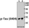 Western blot (WB) analysis of Tau (phospho-S404) polyclonal antibody at 1:500 dilution
Lane1:The Brain tissue lysate of Mouse(40ug)
Lane2:The Brain tissue lysate of Rat(20ug)