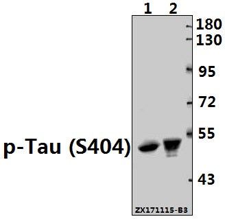 Western blot (WB) analysis of Tau (phospho-S404) polyclonal antibody at 1:500 dilution
Lane1:The Brain tissue lysate of Mouse(40ug)
Lane2:The Brain tissue lysate of Rat(20ug)
