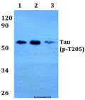 Western blot (WB) analysis of p-Tau (T205) polyclonal antibody at 1:500 dilution
Lane1:HEK293T whole cell lysate
Lane2:Raw264.7 whole cell lysate
Lane3:H9C2 whole cell lysate