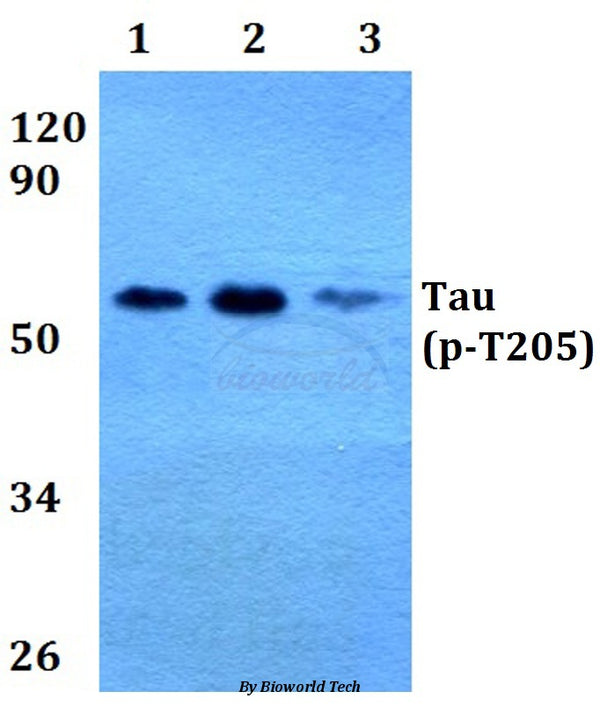 Western blot (WB) analysis of p-Tau (T205) polyclonal antibody at 1:500 dilution
Lane1:HEK293T whole cell lysate
Lane2:Raw264.7 whole cell lysate
Lane3:H9C2 whole cell lysate
