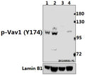 Western blot (WB) analysis of p-Vav1 (Y174) pAb at 1:500 dilution
Lane1:THP-1 whole cell lysate(40ug)
Lane2:HuT78 whole cell lysate(40ug)
Lane3:The Spleen tissue lysate of Mouse(40ug)
Lane4:The Spleen tissue lysate of Rat(40ug)