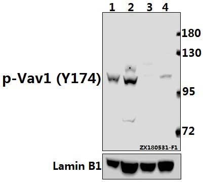 Western blot (WB) analysis of p-Vav1 (Y174) pAb at 1:500 dilution
Lane1:THP-1 whole cell lysate(40ug)
Lane2:HuT78 whole cell lysate(40ug)
Lane3:The Spleen tissue lysate of Mouse(40ug)
Lane4:The Spleen tissue lysate of Rat(40ug)