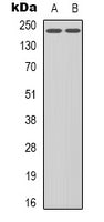 Western blot analysis of VEGFR2 (pY1214) expression in HuvEc (A), HepG2 (B) whole cell lysates.