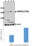 Western blot (WB) analysis of p-WNK1 (T60) pAb at 1:500 dilution
Lane1:HEK293T whole cell lysate(40ug)
Lane2:HEK293T treated with EGF(100ng/ml,30 minutes) whole cell lysate(40ug)
Lane3:PC12 whole cell lysate(40ug)
Lane4:AML-12 whole cell lysate(40ug)