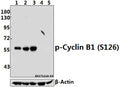 Western blot (WB) analysis of p-Cyclin B1 (S126) pAb at 1:500 dilution
Lane1:MCF-7 whole cell lysate(40ug)
Lane2:HEK293T whole cell lysate(40ug)
Lane3:SGC7901 whole cell lysate(40ug)
Lane4:3T3-L1 whole cell lysate(40ug)
Lane5:PC12 whole cell lysate(40ug)