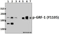 Western blot (WB) analysis of p-GRF-1 (Y1105) pAb at 1:500 dilution
Lane1:The Heart tissue lysate of Rat(40ug)
Lane2:K562 whole cell lysate(40ug)
Lane3:Jurkat whole cell lysate(40ug)
Lane4:The Blood tissue lysate of Mouse(40ug)
Lane5:H1792 whole cell lysate(40ug)
Lane6:HEK293T whole cell lysate(40ug)
Lane7:SP2/0 whole cell lysate(40ug)