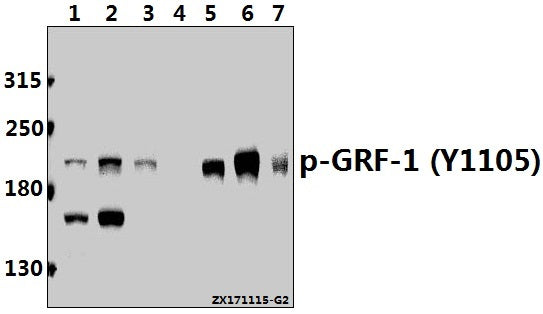 Western blot (WB) analysis of p-GRF-1 (Y1105) pAb at 1:500 dilution
Lane1:The Heart tissue lysate of Rat(40ug)
Lane2:K562 whole cell lysate(40ug)
Lane3:Jurkat whole cell lysate(40ug)
Lane4:The Blood tissue lysate of Mouse(40ug)
Lane5:H1792 whole cell lysate(40ug)
Lane6:HEK293T whole cell lysate(40ug)
Lane7:SP2/0 whole cell lysate(40ug)