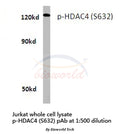 Western blot (WB) analysis of p-HDAC4 (S632) polyclonal antibody in extracts from Jurkat cells.