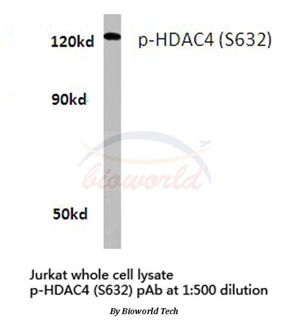 Western blot (WB) analysis of p-HDAC4 (S632) polyclonal antibody in extracts from Jurkat cells.