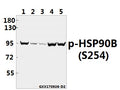 Western blot (WB) analysis of HSP90B (phospho-S254) pAb at 1:5000 dilution
Lane1:MCF-7 whole cell lysate(40ug)
Lane2:The Testis tissue lysate of Mouse(40ug)
Lane3:The Testis tissue lysate of Rat(40ug)
Lane4:HEK293T whole cell lysate(40ug)
Lane5:Hela whole cell lysate(40ug)
