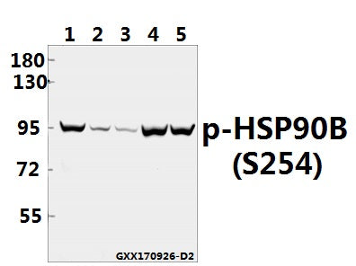 Western blot (WB) analysis of HSP90B (phospho-S254) pAb at 1:5000 dilution
Lane1:MCF-7 whole cell lysate(40ug)
Lane2:The Testis tissue lysate of Mouse(40ug)
Lane3:The Testis tissue lysate of Rat(40ug)
Lane4:HEK293T whole cell lysate(40ug)
Lane5:Hela whole cell lysate(40ug)