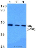 Western blot (WB) analysis of p-IKKγ (S31) polyclonal antibody at 1:500 dilution
Lane1:HEK293T cell lysate treated with TNFa(20ng/ml,15mins)
Lane2:Raw264.7 cell lysate treated with TNFa(20ng/ml,15mins)
Lane3:PC12 cell lysate treated with TNFa(20ng/ml,15mins)
