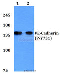 Western blot (WB) analysis of p-VE-Cadherin (Y731) polyclonal antibody at 1:500 dilution
Lane1:Hela cell lysate treated with EGF(0.1ng/ml,30mins)
Lane2:H9C2 cell lysate treated with EGF(0.1ng/ml,30mins)
