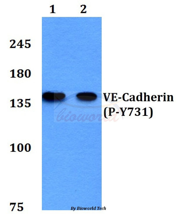 Western blot (WB) analysis of p-VE-Cadherin (Y731) polyclonal antibody at 1:500 dilution
Lane1:Hela cell lysate treated with EGF(0.1ng/ml,30mins)
Lane2:H9C2 cell lysate treated with EGF(0.1ng/ml,30mins)
