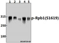 Western blot (WB) analysis of p-Rpb1 (S1619) pAb at 1:2000 dilution
Lane1:A549 whole cell lysate(40ug)
Lane2:Hela whole cell lysate(40ug)
Lane3:A2780 whole cell lysate(40ug)
Lane4:PC12 whole cell lysate(40ug)
Lane5:3T3-L1 whole cell lysate(40ug)