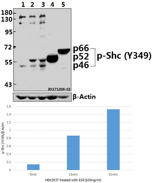 Western blot (WB) analysis of p-Shc (Y349) pAb at 1:500 dilution
Lane1:HEK293T whole cell lysate
Lane2:HEK293T treated with EGF(100ng/ml,15 minutes) whole cell lysate
Lane3:HEK293T treated with EGF(100ng/ml,30 minutes) whole cell lysate
Lane4:The Kidney tissue lysate of Mouse
Lane5:The Kidney tissue lysate of Rat
