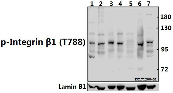 Western blot (WB) analysis of p-Integrin β1 (T788) pAb at 1:500 dilution
Lane1:CT26 whole cell lysate(40ug)
Lane2:PC12 whole cell lysate(40ug)
Lane3:SK-OVCAR3 whole cell lysate(40ug)
Lane4:A2780 whole cell lysate(40ug)
Lane5:HCT116 whole cell lysate(40ug)
Lane6:HEK293T whole cell lysate(40ug)
Lane7:Hela whole cell lysate(40ug)