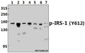 Western blot (WB) analysis of p-IRS-1 (Y612) pAb at 1:500 dilution
Lane1:MCF-7 whole cell lysate(40ug)
Lane2:HEK293T whole cell lysate(40ug)
Lane3:A375 whole cell lysate(40ug)
Lane4:A2780 whole cell lysate(40ug)
Lane5:Hela whole cell lysate(40ug)
Lane6:C6 whole cell lysate(40ug)
Lane7:NIH-3T3 whole cell lysate(40ug)
