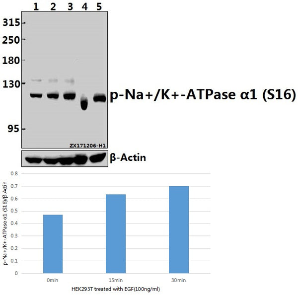 Western blot (WB) analysis of p-Na+/K+-ATPase α1 (S16) pAb at 1:2000 dilution
Lane1:HEK293T whole cell lysate
Lane2:HEK293T treated with EGF(100ng/ml,15 minutes) whole cell lysate
Lane3:HEK293T treated with EGF(100ng/ml,30 minutes) whole cell lysate
Lane4:C6 whole cell lysate
Lane5:NIH-3T3 whole cell lysate