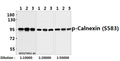 Western blot (WB) analysis of Calnexin (phospho-S583) pAb at 1:10000 to 1:50000 dilution
Lane1:HEK293T whole cell lysate(40ug)
Lane2:SGC7901 whole cell lysate(40ug)
Lane3:A375 whole cell lysate(40ug)