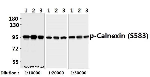 Western blot (WB) analysis of Calnexin (phospho-S583) pAb at 1:10000 to 1:50000 dilution
Lane1:HEK293T whole cell lysate(40ug)
Lane2:SGC7901 whole cell lysate(40ug)
Lane3:A375 whole cell lysate(40ug)
