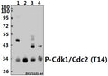 Western blot (WB) analysis of p-Cdk1/Cdc2 (T14) pAb at 1:500 dilution
Lane1:Hela whole cell lysate(40ug)
Lane2:PC3 whole cell lysate(40ug)
Lane3:The Testis tissue lysate of Mouse(40ug)
Lane4:The Testis tissue lysate of Rat(40ug)