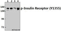 Western blot (WB) analysis of p-Insulin Receptor (Y1355) pAb at 1:500 dilution
Lane1:H1792 whole cell lysate(40ug)
Lane2:HepG2 whole cell lysate(40ug)
Lane3:A549 whole cell lysate(40ug)
Lane4:L02 whole cell lysate(40ug)