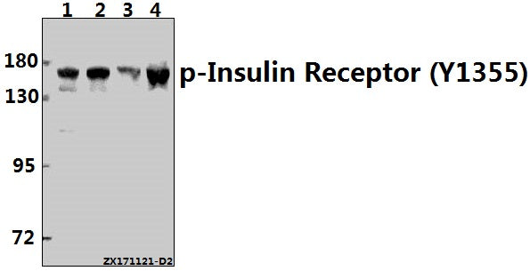 Western blot (WB) analysis of p-Insulin Receptor (Y1355) pAb at 1:500 dilution
Lane1:H1792 whole cell lysate(40ug)
Lane2:HepG2 whole cell lysate(40ug)
Lane3:A549 whole cell lysate(40ug)
Lane4:L02 whole cell lysate(40ug)