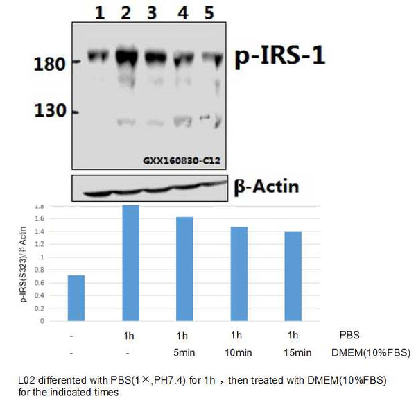 Western blot (WB) analysis of p-IRS-1 (S323) polyclonal antibody at 1:500 dilution
Lane1:L02 whole cell lysate(40ug)
Lane2:L02 treated with PBS(1×PBS,PH7.4) for 1 houre whole cell lysate
Lane3:L02 treated with PBS(1×PBS,PH7.4) for 1 houre then treated with DMEM(10%FBS) for 5min whole cell lysate
Lane4:L02 treated with PBS(1×PBS,PH7.4) for 1 houre then treated with DMEM(10%FBS) for 10min whole cell lysate
Lane5:L02 treated with PBS(1×PBS,PH7.4) for 1 houre then treated with DMEM(10%FBS) for 15min